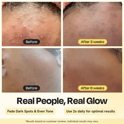 Gleamin Advanced Brightening Moisturizer